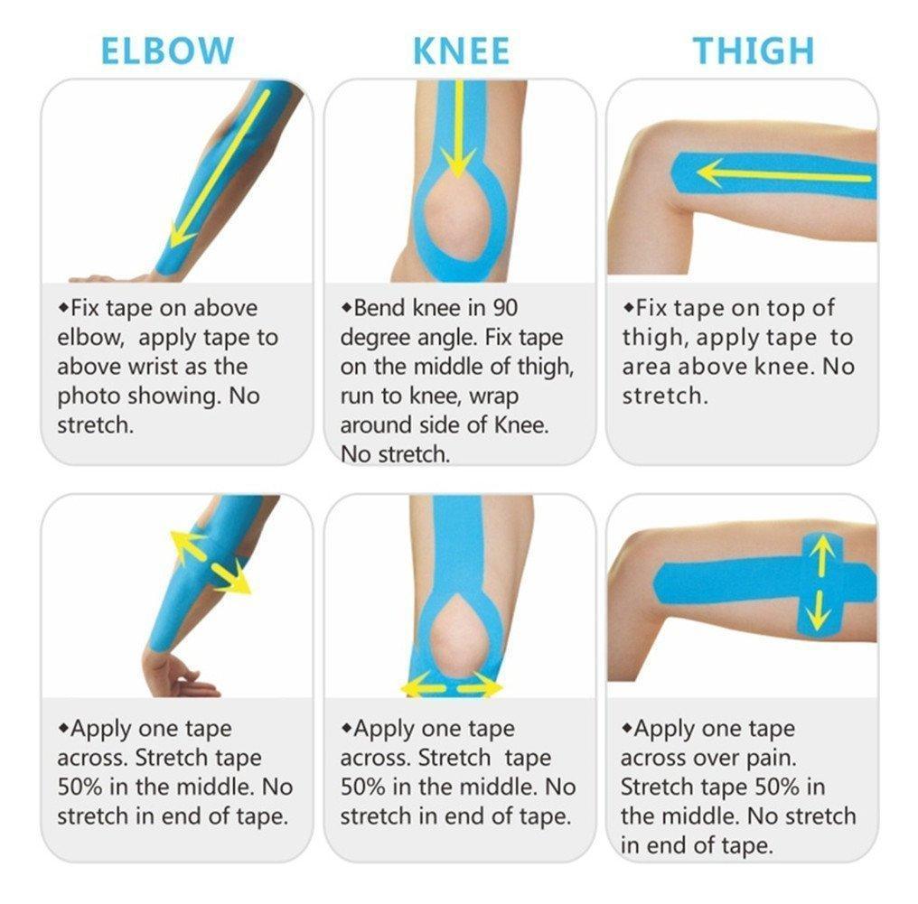 Kinesiology Tape