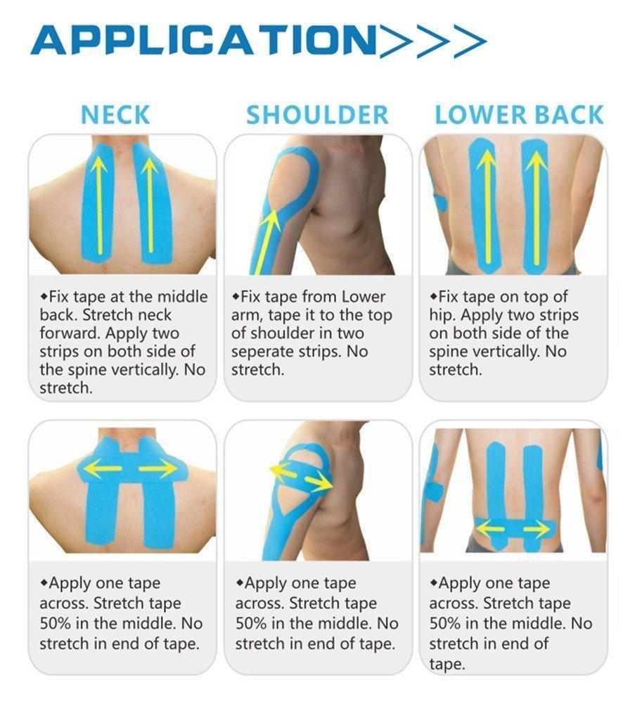 Kinesiology Tape