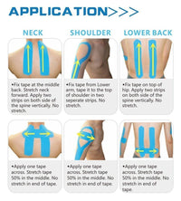 Thumbnail for Use of Kinesiology Tape